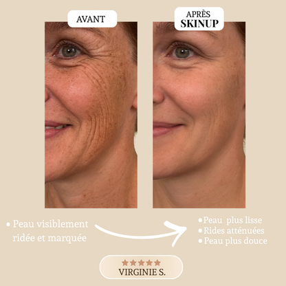 Ruban Collagène Skinup™