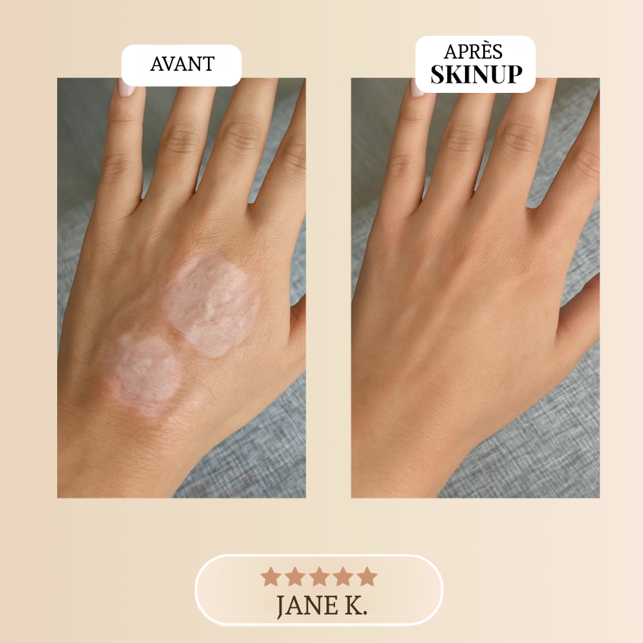 Ruban Collagène Skinup™