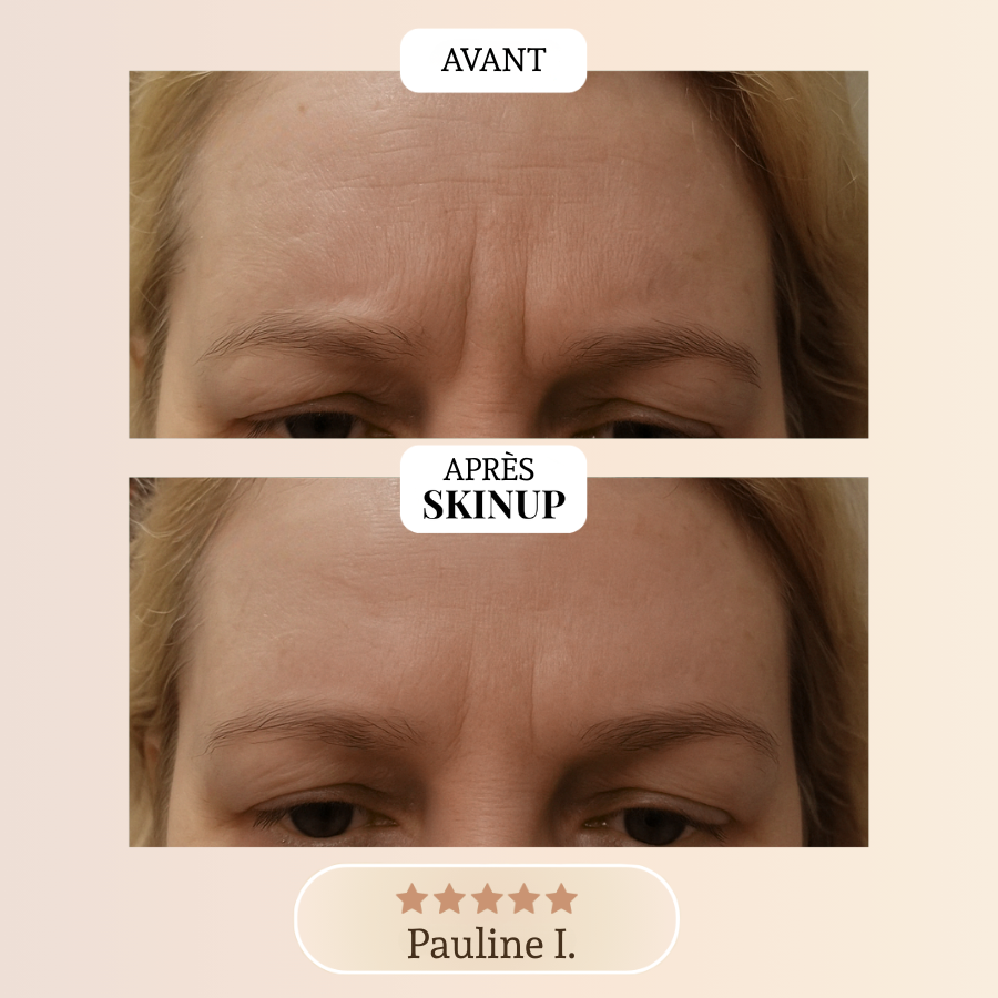 Ruban Collagène Skinup™