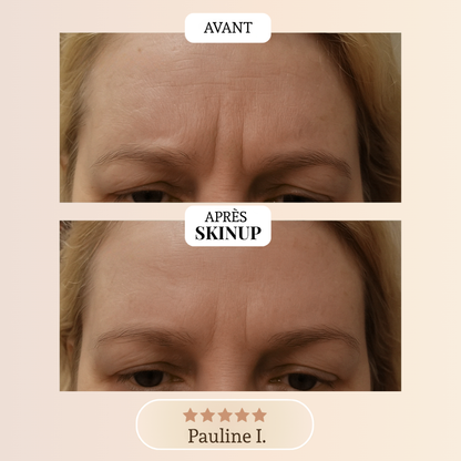 Ruban Collagène Skinup™