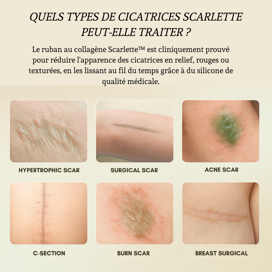 Ruban Collagène Skinup™